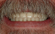 Restores appearance and function 1