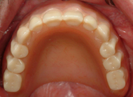 Restores appearance and function 3