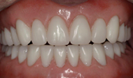 Restores smile and function 2